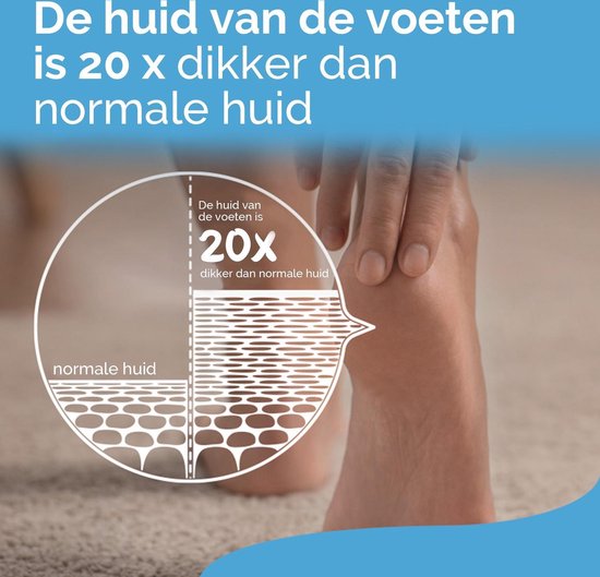 Scholl Scrub - Voetenscrub - 75ml - 1 Stuk