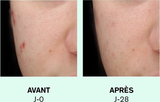 Lierac Sebologie Double Concentrate Intensive Treatment Imperfections 30ml
